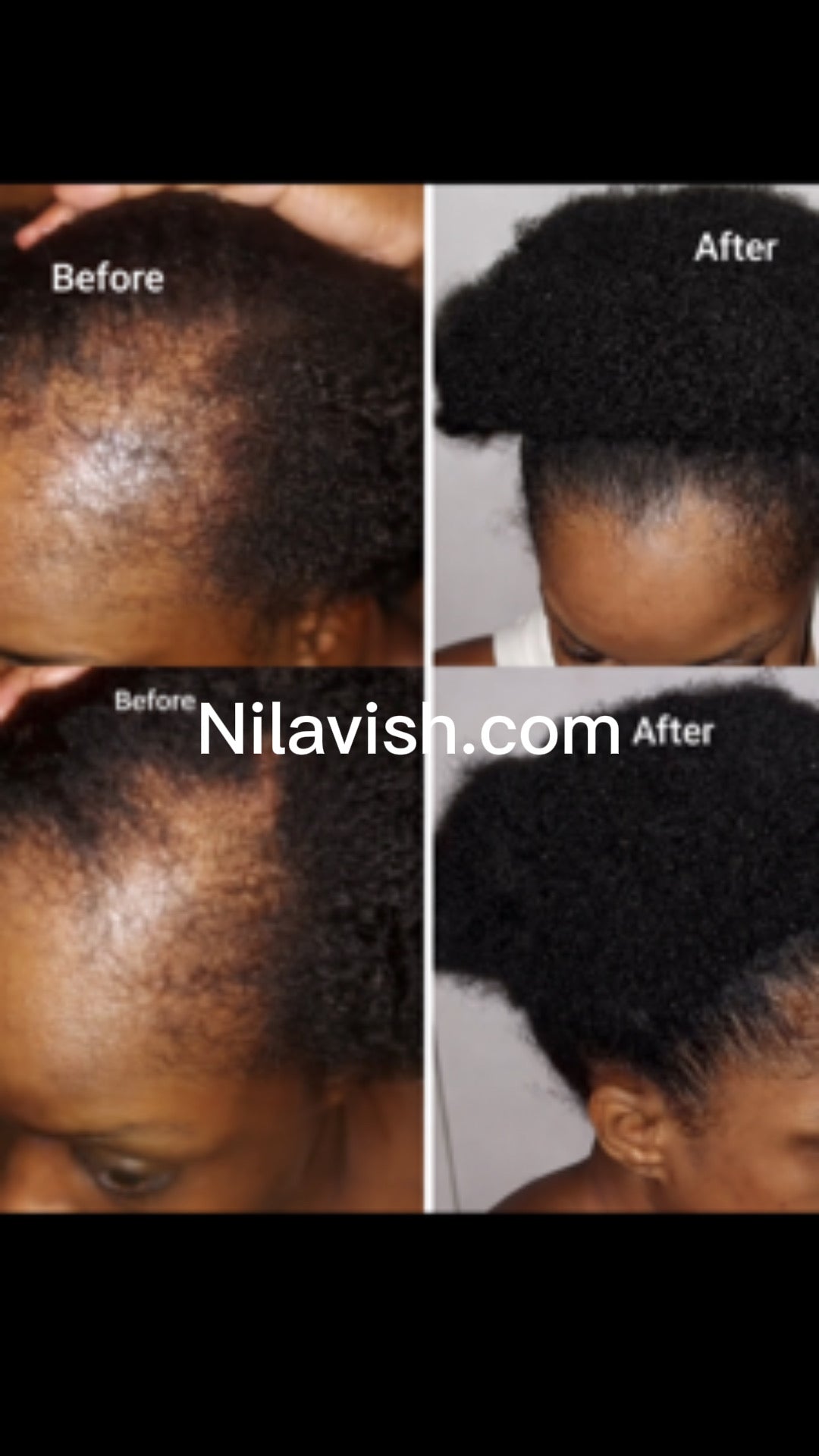 Rapid Hair Growth Oil-4 fl. oz.